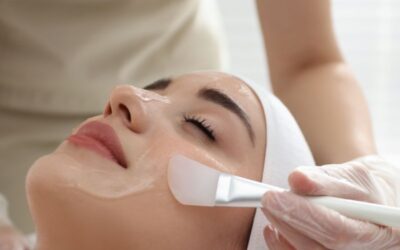 Peeling químico facial