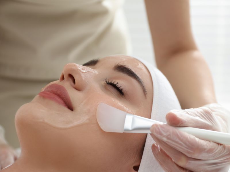 peeling quimico facial