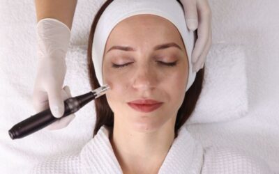 Tratamientos despigmentantes para reducir manchas